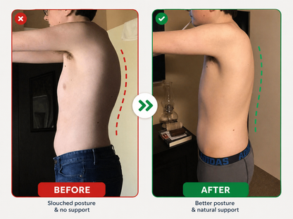 Instant Posture Corrector by Clarico